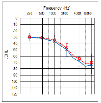 Figure 1. The average audiogram for the 10 subjects, with the standard deviations shown as the vertical bars at the respective audiometric frequencies.